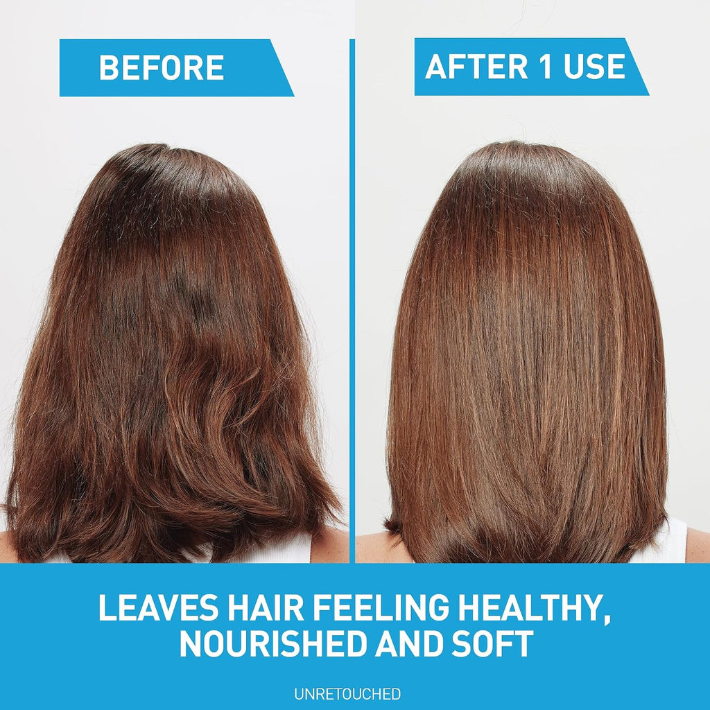 CeraVe Hydrating Anti Dandruff Shampoo. 1% Pyrithione Zinc Dandruff Treatment With Ceramides. Niacinamide. Hyaluronic Acid. Eliminate Flake.Provides Itchy Scalp Relief. Sulfate-Free. 12 Oz (Pack of 2)