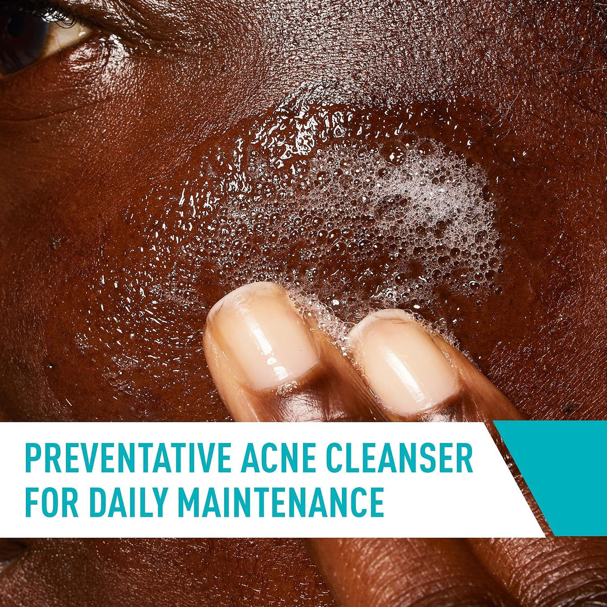 CeraVe Acne Control Cleanser. Face Wash with 2% Salicylic Acid. 8 oz | Skin Care with Niacinamide. Acne Face Wash. Acne Treatment For Face. Ceramides. Fragrance Free. Gentle. Oil Absorbing Clay